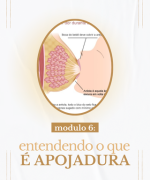 modulo 6_ cuidados na pojadura